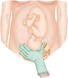 The nurse is performing Leopold's maneuvers on a client. Which figure depicts the Leopold's maneuver that determines whether the fetal presenting part is engaged in the maternal pelvis. Refer to Figures a to d A) B) C) D)