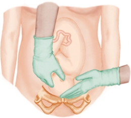 The nurse is performing Leopold's maneuvers on a client. Which figure depicts the Leopold's maneuver that determines whether the fetal presenting part is engaged in the maternal pelvis. Refer to Figures a to d A) B) C) D)