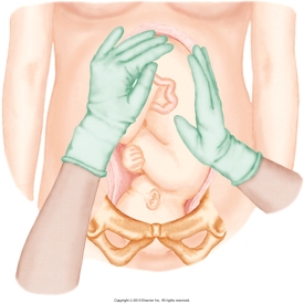 The nurse is performing Leopold's maneuvers on her patient. Which figure depicts the Leopold's maneuver that determines whether the fetal presenting part is engaged in the maternal pelvis? Refer to Figures A to D. A)    B)    C)    D)   