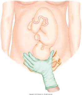 The nurse is performing Leopold's maneuvers on her patient. Which figure depicts the Leopold's maneuver that determines whether the fetal presenting part is engaged in the maternal pelvis? Refer to Figures A to D. A)    B)    C)    D)   