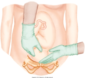 The nurse is performing Leopold's maneuvers on her patient. Which figure depicts the Leopold's maneuver that determines whether the fetal presenting part is engaged in the maternal pelvis? Refer to Figures A to D. A)    B)    C)    D)   