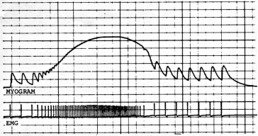 The graph below was generated by students in a physiology lab.The top trace (myogram)shows contraction force, the bottom (EMG)shows the electrical stimulus.On the graph, label a muscle twitch.What property of muscle is being tested here? What caused the increase in force (and subsequent decrease)?   