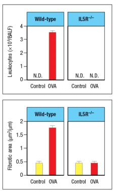 Allergen-induced airway remodeling in mice is used as a model for human allergic asthma. This disease is induced by first sensitizing mice to the protein antigen, chicken ovalbumin (OVA)  by intraperitoneal immunization with OVA in a T<sub>H</sub>2-inducing adjuvant. Three weeks later, mice are challenged by inhalation of aerosolized OVA (or saline alone, as a control)  daily for the following three weeks. At the end of the entire six week period, the lungs of the mice are examined for leukocyte numbers in the bronchial alveolar lavage fluid (BALF)  and for tissue remodeling as assessed by measuring fibrotic areas in the lung tissue. To determine the cell type most likely responsible for the tissue damage in this disease, IL-5 receptor-deficient mice (IL5R<sup>-/-</sup>)  are compared to wild-type, as shown in Figure Q13) .   airway remodeling disease model is: A)  Neutrophils B)  Macrophages C)  Mast cells D)  T<sub>H</sub>2 cells E)  Eosinophils