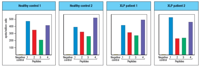  Patients with X-linked lymphoproliferative syndrome type 1 (XLP1)  have mutations in the SLAM-family adapter protein, SAP. These patients suffer from an inability to control infections of the herpesvirus Epstein-Barr virus (EBV)  that infects B cells. Studies have been done using peripheral blood T cells from these patients to examine their response to EBV in comparison to the responses of normal individuals (EBV-infected)  as controls. These data were obtained by ELISPOT analysis, to quantify the numbers of IFN- \gamma -producing CD8 T cells per million peripheral blood leukocytes in response to several EBV peptides, indicated as peptide 1, 2, 3, or 4 (note: the patients and controls were matched for HLA class I molecules) .     These results indicate that: A)  XLP patients have a defect in priming CD8 T cell responses following EBV infection. B)  XLP patients require IFN- \gamma  production to kill EBV-infected B cells. C)  XLP patients have normal CD8 effector cell priming following EBV infection. D)  XLP patients have a defect in cytotoxicity by NK cells rather than by CD8 T cells. E)  XLP patients have no defect in cytotoxicity by CD8 T cells. 