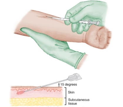 A registered nurse is watching a student nurse give an IM injection to a 1-year-old.The student identifies the following site for the injection.What action by the registered nurse is best?   A)  Remind the student to don gloves. B)  Hand the student an alcohol wipe. C)  Ask the student to find another site. D)  Assess for the correct needle length.