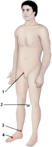 When the nurse is screening patients for possible peripheral arterial disease,indicate where the posterior tibial artery will be palpated.   A) 1 B) 2 C) 3 D) 4