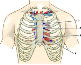 <strong>The nurse is caring for a patient with mitral regurgitation. Referring to the figure below,where should the nurse listen to best hear a murmur typical of mitral regurgitation?  </strong> A)1 B)2 C)3 D)4 <div style=padding-top: 35px> 
