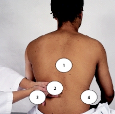 When assessing a patient with a urinary tract infection,indicate on the accompanying figure where the nurse will percuss to assess for possible pyelonephritis.   A) 1 B) 2 C) 3 D) 4