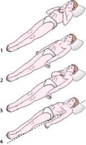 During change-of-shift report,the nurse learns that a patient with a head injury has decorticate posturing to noxious stimulation. Which positioning shown in the accompanying figure will the nurse expect to observe?   A) 1 B) 2 C) 3 D) 4