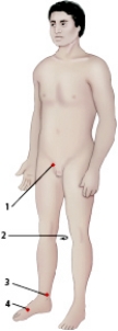When the nurse is screening patients for possible peripheral arterial disease,indicate where the posterior tibial artery will be palpated.   A)  1 B)  2 C)  3 D)  4