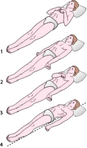 During change-of-shift report,the nurse learns that a patient with a head injury has decorticate posturing to noxious stimulation.Which positioning shown in the accompanying figure will the nurse expect to observe?   A)  1 B)  2 C)  3 D)  4