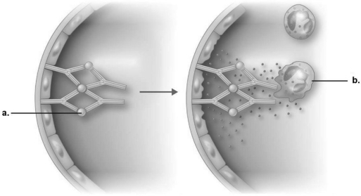 Figure 19.1    -In immune complex reaction shown in Figure 19.1, what is the end result of the reaction? A)  Complement is activated. B)  Neutrophils are attracted and release enzymes. C)  Antibodies destroy neutrophils. D)  IgG is directed against cell membrane antigens. E)  Endothelial cells are damaged.