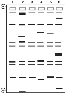 Figure 10.3 This figure shows the results of a gel electrophoresis separation of restriction fragments of the DNA of different organisms.   In Figure 10.3, which two are most closely related? A)  2 and 5 B)  4 and 5 C)  2 and 4 D)  1 and 3 E)  3 and 5