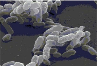 Figure 1.1   The bacterial shape of the cells in the scanning electron micrograph shown in Figure 1.1 would best be described as A)  spiral. B)  bacillus. C)  columnar. D)  ovoid. E)  coccus.