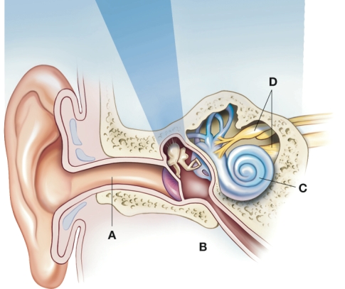The patient has been diagnosed with swimmer's ear. The nurse administers medications focused at treating a disorder of which part of the ear? Indicate the area on this diagram.   A)  A B)  B C)  C D)  D
