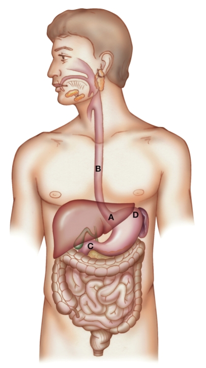 The nurse is using this diagram to teach a patient about GERD. Which spot would the nurse identify as the cardiac sphincter?   A)  A B)  B C)  C D)  D