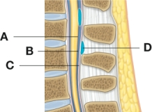 The nurse explaining epidural anesthesia to a patient would indicate which area as the placement for this type of anesthesia?   A)  A B)  B C)  C D)  D