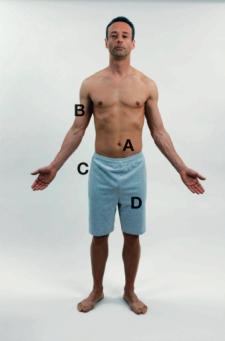 The nurse is providing discharge medication instruction to the family of a child who is severely allergic to peanuts. Mark the spot where the family or patient should inject epinephrine from an EpiPen should an allergic response occur.   A)  A B)  B C)  C D)  D
