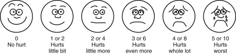 <strong>The nurse is completing a pain assessment on a 4-year-old child. Which of the depicted pain scale tools should the nurse use with a child this age?</strong> A) B) C) D)