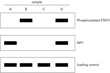 Neuronal samples from wild-type mice were monitored in the absence and presence of leptin via Western blotting. The data are shown below. Choose the answer that correctly identifies the NPY/AGRP neuronal samples obtained in the absence and then the presence of leptin.   A)  B; C B)  D; B C)  A; C D)  C; A