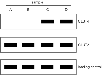 Membrane fractions of skeletal muscle and adipose tissue were purified. Before purification the samples were exposed to insulin or glucagon. The samples were then analyzed via Western blotting using antibodies against GLUT4 and GLUT2. A loading control was included in the analysis. The results are shown below. Assume that sample A is skeletal muscle. Which sample corresponds to skeletal muscle that has been exposed to insulin? Explain your choice.   