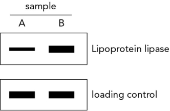 Samples of adipose tissue from a patient were analyzed by Western blot. Samples were obtained before and after treatment with a drug aimed to treat type 2 diabetes. Given the data shown, determine which sample (A or B) was obtained after drug administration. Discuss your reasoning and include the name of the drug that was used in the study.   