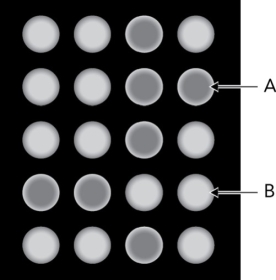 <strong>The figure below is a fluorescence readout from a lectin array. What can be deduced from A? </strong> A) There is no interaction between the glycan and the lectin in the well. B) There is a glycan-lectin interaction in the well. C) There is an interaction, but there is no way to determine the species that are interacting. D) Glycan cleavage from the glycoconjugate has been achieved.
