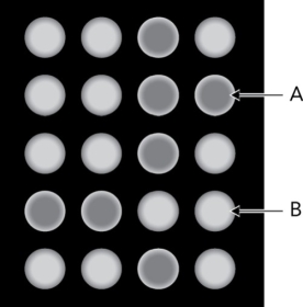 The figure below is a fluorescence readout from a lectin array. What can be deduced from B?   A)  There is no interaction between the glycan and the lectin in the well. B)  There is a glycan-lectin interaction in the well. C)  There is an interaction, but there is no way to determine the species that are interacting. D)  Glycan cleavage from the glycoconjugate has been achieved.