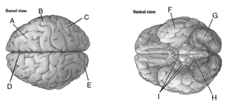 Match the letters to the correct location on the figure.    _____ 1.  occipital lobe _____ 2.  brainstem _____ 3.  temporal lobe _____ 4.  frontal lobe _____ 5.  longitudinal fissure _____ 6.  cerebellum _____ 7.  cranial nerves _____ 8.  central sulcus _____ 9.  parietal lobe