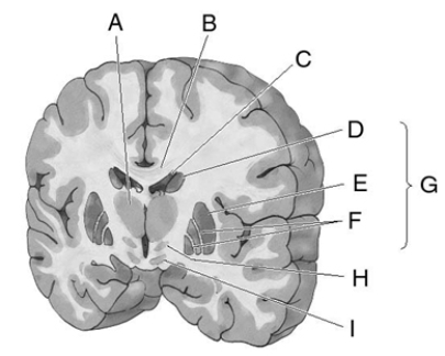 Match the letter to the correct brain structure.    _____ 1. caudate nucleus _____ 2. lateral ventricle _____ 3. basal ganglia _____ 4. substantia nigra _____ 5. subthalamic nucleus _____ 6. thalamus _____ 7. putamen _____ 8. globus pallidus _____ 9. corpus callosum