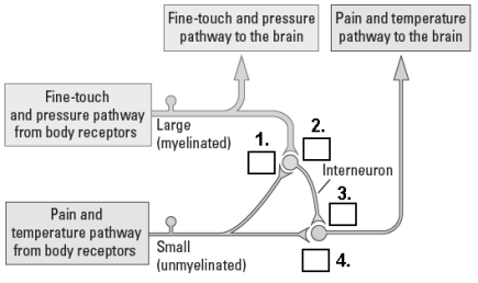 Please indicate which parts of the pain circuit are excitatory (+)and which are inhibitory (-).    1._____ 2._____ 3._____ 4._____