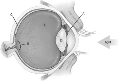   -Olfactory dysfunction, or dysosmia, is a problem with the sense of smell. Technically, it is a deviation from the normal sensing and perception of odor molecules, or olfactory stimuli processing. There are several different forms of dysosmia, including anosmia (stimuli do not activate the olfactory bulb) , parosmia (some odors are interpreted as other odors) , and phantosmia (hallucinations of smells that are not there) . Based on this information, what specific condition is indicated in a person who mistakenly perceives the smell of peppermint as the same as the smell of something that is rotten, foul, and decomposed? A)  Dysosmia B)  Anosmia C)  Phantosmia D)  Parosmia