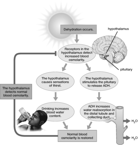 Refer to the following diagram. Which of the following could result from localized brain damage to the pituitary gland?   A)  Complete loss of urination B)  Increased permeability of the collecting duct C)  Extremely concentrated urine production D)  Water retention and bloating E)  Forming large amounts of dilute urine