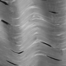 The tissue shown in the photograph forms   A)  dense connective tissue. B)  smooth muscle. C)  bone. D)  skeletal muscle. E)  nerves.