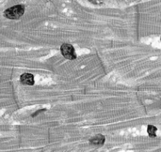 This tissue is   A)  simple epithelium. B)  smooth muscle. C)  cardiac muscle. D)  adipose tissue. E)  nerve tissue.