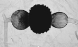 The structure in the photograph is a(n)    A)  seed. B)  ascus. C)  zygosporangium. D)  glomeromycete. E)  basidium.