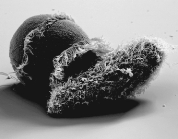The organisms in the photo belong to the group   A)  euglenozoans. B)  stramenopiles. C)  rhizarians. D)  alveolates. E)  excavates.