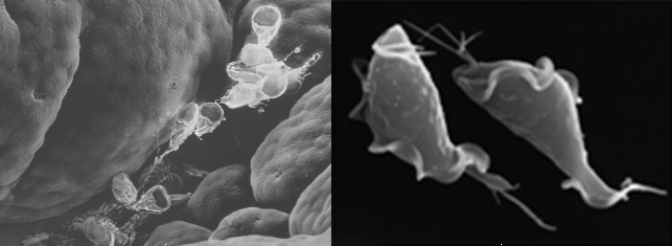 What characteristic do the organisms in the photos share?   A)  Both have calcium carbonate shells. B)  Both are parasites. C)  Both are multicellular. D)  Both are photosynthetic. E)  Both use pseudopods to capture food.