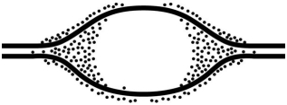    Grains represent radioactive material within the replicating eye. -In an experiment,DNA is allowed to replicate in an environment with all necessary enzymes,dATP,dCTP,dGTP,and radioactively labeled dTTP (³H thymidine) for several minutes and then switched to nonradioactive medium.It is then viewed by electron microscopy and autoradiography.The figure above represents the results. Which of the following is the most likely interpretation? A) There are two replication forks going in opposite directions. B) Thymidine is only being added where the DNA strands are furthest apart. C) Thymidine is only added at the very beginning of replication. D) Replication proceeds in one direction only. E) Thymidine is not being incorporated into the DNA, but is associating with the DNA due to hydrogen bonding. 