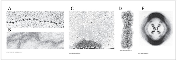    The images above are of DNA at various levels of coiling and folding.Use this image to answer the questions below. -Which image represents the 10 nm fibre,showing nucleosomes? A) A B) B C) C D) D E) E