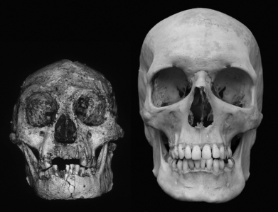 What is one possible explanation offered by some scholars to explain the  Hobbit  of Flores Island, Indonesia?   A)  The island climate evolved a unique species of human in a very short period of time. B)  This is a case of mixed-species breeding. C)  The  Hobbit  is actually not a human fossil at all. D)  This is a case of microcephaly.