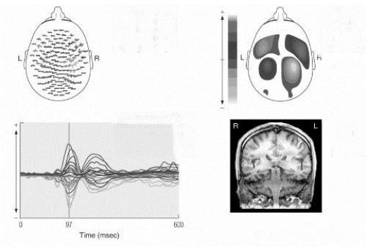    -(see Figure 1.11) The image in the lower right of this figure combines information from ____________________ with information from ____________________ imaging.