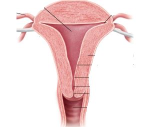 A pregnant client is scheduled for a lower-segment cesarean birth. Place an X on the area of the uterine structure where the nurse should instruct that this incision for the procedure will be placed.Shape_   
