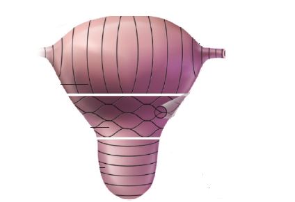 After delivery, the nurse notes that a client is having considerable vaginal bleeding. On the diagram provided, identify the area of the myometrium that is responsible for stopping bleeding after birth.Shape_  