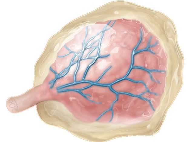 The nurse is preparing instruction on placental and umbilical cord variations. Which diagram should the nurse use to explain succenturiate placenta?  A)     B)     C)     D)    
