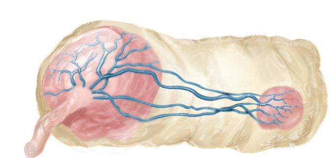 The nurse is preparing instruction on placental and umbilical cord variations. Which diagram should the nurse use to explain succenturiate placenta?  A)     B)     C)     D)    