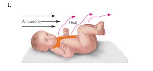 The nurse is teaching a group of new parents on ways to ensure body heat regulation of their newborns. Which diagram should the nurse use to explain the process of radiation?  A)     B)    C)    D)    