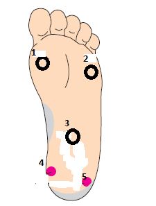 The nurse is caring for a newborn with hypoglycemia. Which areas on the diagram should the nurse use to obtain blood to assess this newborn's blood glucose levels? Select all that apply.   A) 1 B) 2 C) 3 D) 4 E) 5