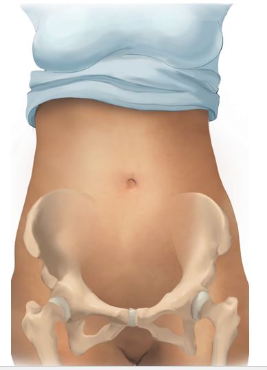 The nurse is assessing the abdomen of a client who delivered an infant 1 hour ago. On the diagram, where should the nurse assess the client's uterine level?  