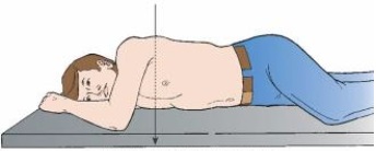 The body position depicted below results in which x-ray projection?   A)  PA oblique B)  AP oblique C)  Recumbent D)  Mediolateral
